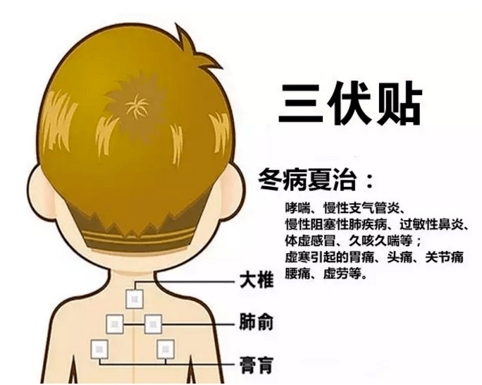 1、三伏貼多大？寶寶能貼多少？</p><p>三伏貼孩子貼多久？