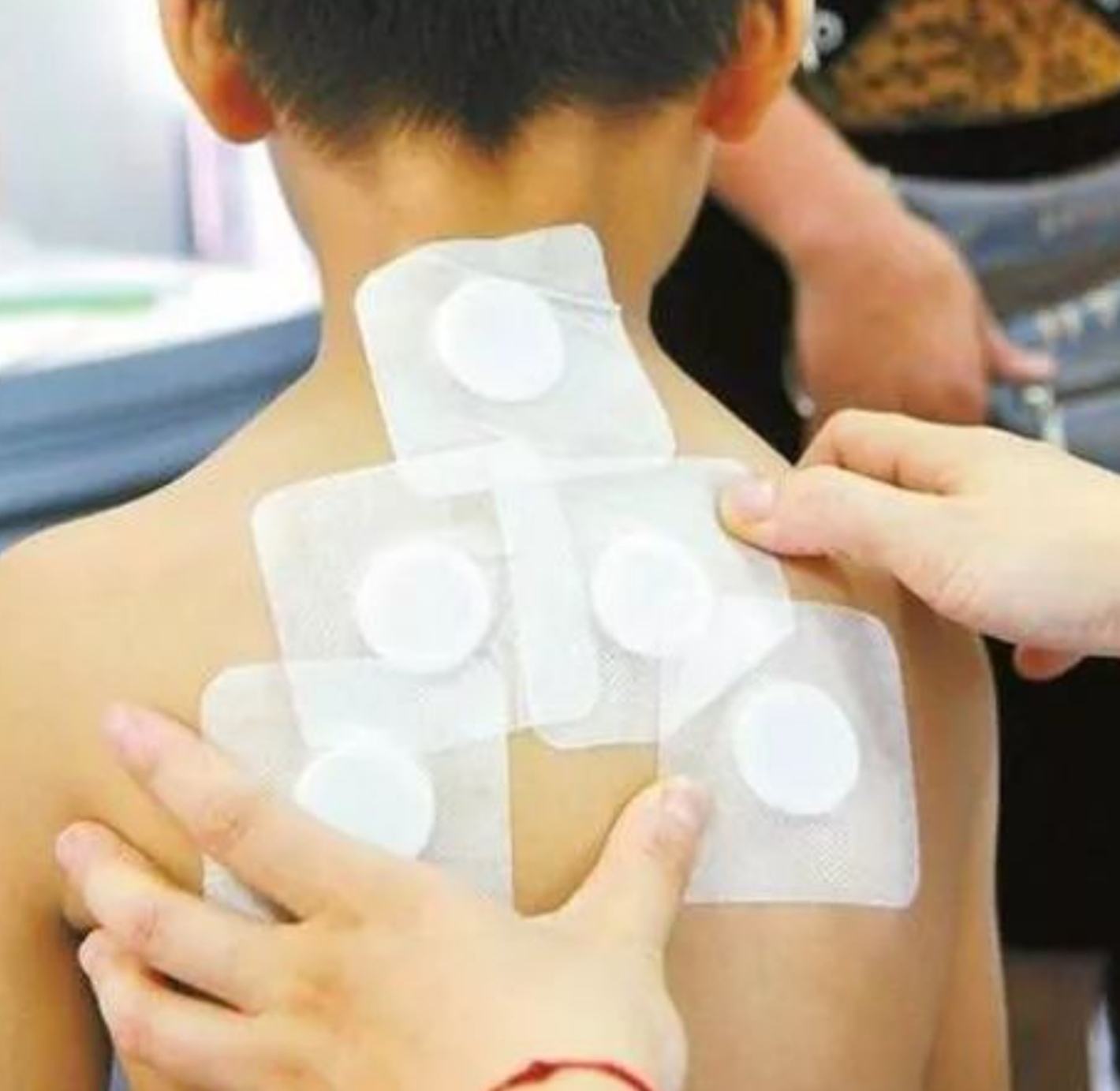 2、三伏貼在脖子上，有一根針，看起來(lái)很疼。怎么了